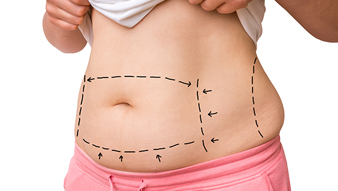 Убрать живот и бока в домашних условиях