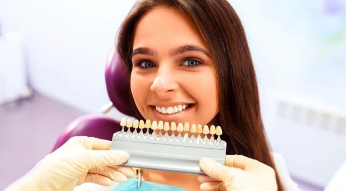 Керамические виниры для зубов