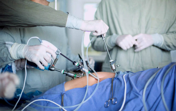 Все, что вам нужно знать о абдоминальной хирургии