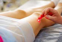 Эндовазальная лазерная коагуляция вен: что это, плюсы, чего ожидать во время и после лечения