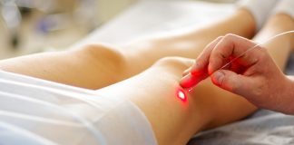 Эндовазальная лазерная коагуляция вен: что это, плюсы, чего ожидать во время и после лечения