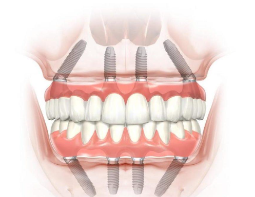 Инновационные методы лечения зубов: подробности
