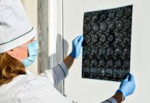 Магнитно-резонансная томография: следим за здоровьем головы