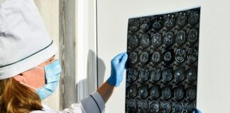 Магнитно-резонансная томография: следим за здоровьем головы