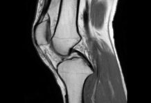 МРТ коленного сустава: полное руководство
