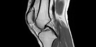 МРТ коленного сустава: полное руководство