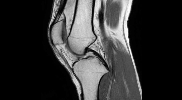 МРТ коленного сустава: полное руководство